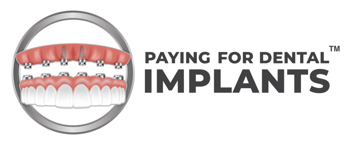 Paying For Dental Implants